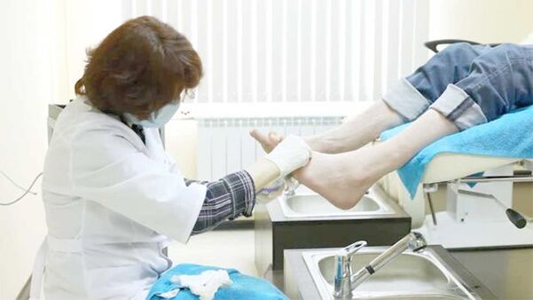 Dermatolog zdravi glivice na nohtih